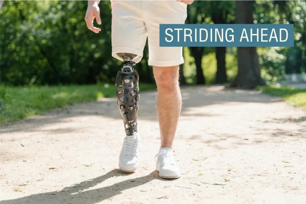La pierna biónica ofrece esperanza a los amputados